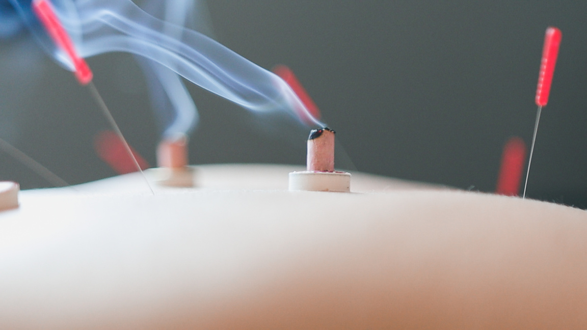 Acupuncture and moxibustion on the Human Body